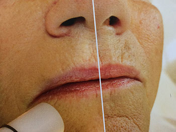 abrahydri Kosmetik Sollberger